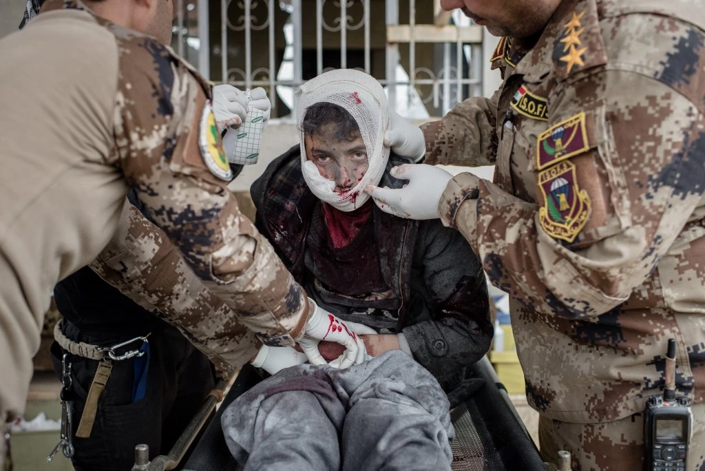 A young boy, wounded by shrapnel in his face and groin, is treated at a clinic in the Samah neighborhood of Mosul, Iraq on Dec. 1, 2016. He continued to drip blood through the gauze and bandages the medics wrapped him in before loading him into an ambulance.