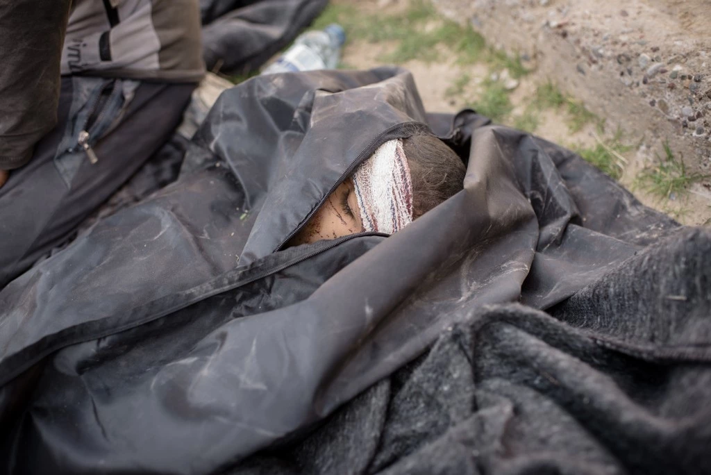A dead child lies in a body bag at a clinic south of Mosul, Iraq on Feb. 23, 2017.